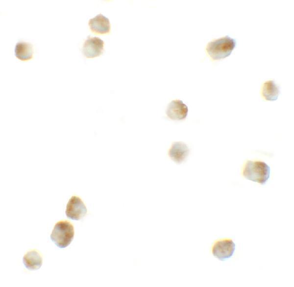 a00722 rock1 primary antibodies icc testing 2