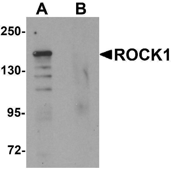 a00722 rock1 primary antibodies wb testing 1