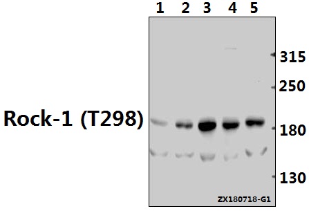 a00722t298 rock1 primary antiboties wb testing 1