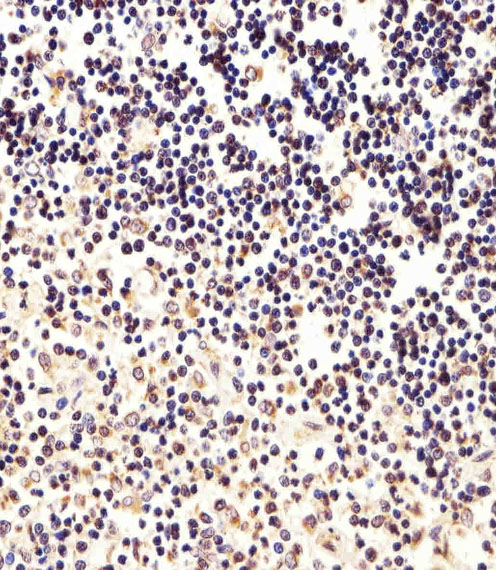 Immunohistochemical analysis of paraffin-embedded H