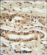 FOXP1 Antibody (C-term) IHC analysis in formalin fixed and paraffin embedded lung tissue followed by peroxidase conjugation of the secondary antibody and DAB staining