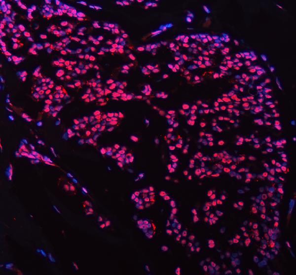 a00723 foxp1 primary antibodies if testing 1