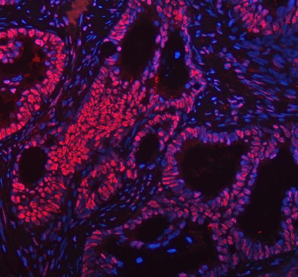 a00723 foxp1 primary antibodies if testing 2