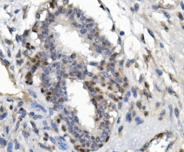 a00723 foxp1 primary antibodies ihc testing 2