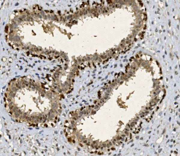 a00723 foxp1 primary antibodies ihc testing 3