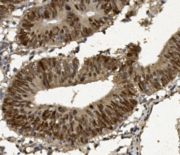 a00723 foxp1 primary antibodies ihc testing 4