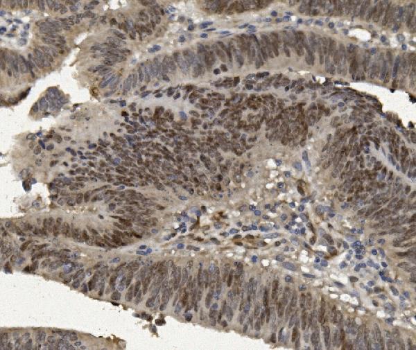 a00723 foxp1 primary antibodies ihc testing 5
