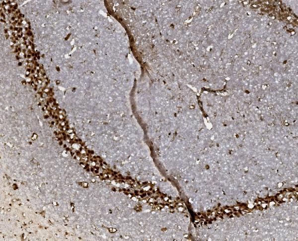 a00723 foxp1 primary antibodies ihc testing 6
