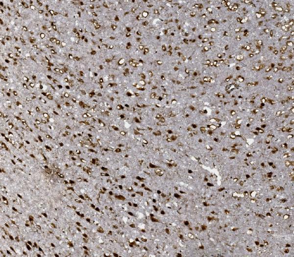 a00723 foxp1 primary antibodies ihc testing 7