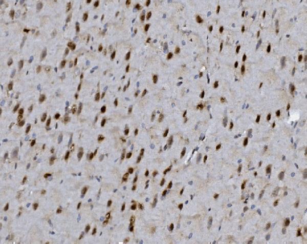 a00723 foxp1 primary antibodies ihc testing 8