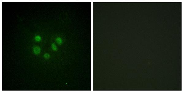 Immunofluorescence analysis of A549 cells, using Bloom Syndrome Antibody