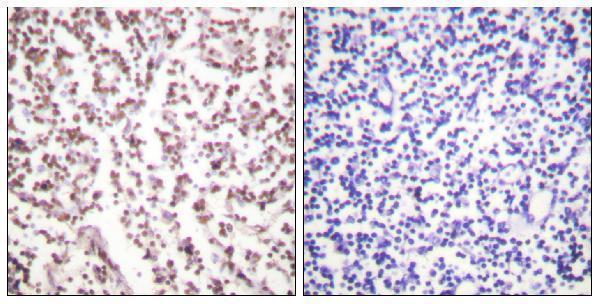 Immunohistochemistry analysis of paraffin-embedded human lymph node tissue, using Bloom Syndrome Antibody