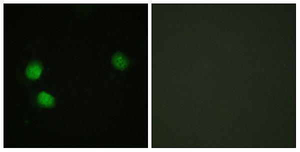 Immunofluorescence analysis of HeLa cells, using Bloom Syndrome (Phospho-Thr99) Antibody