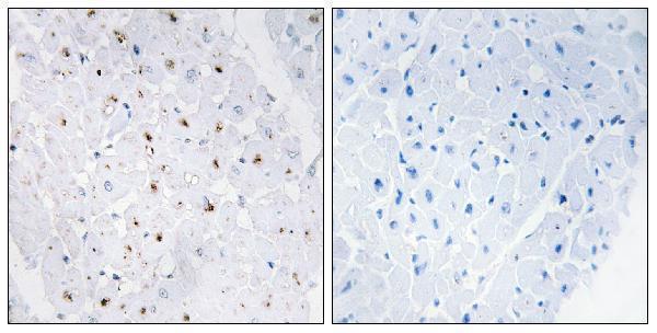 Immunohistochemistry analysis of paraffin-embedded human heart, using Bloom Syndrome (Phospho-Thr99) Antibody