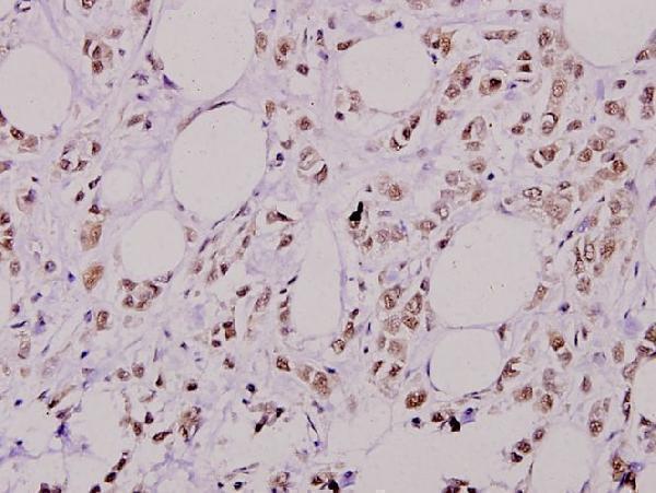 a00725s474 akt2 primary antiboties ihc testing 2