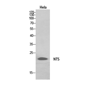 Western Blot analysis of HeLa, HepG2 cells using Neurotensin Polyclonal Antibody