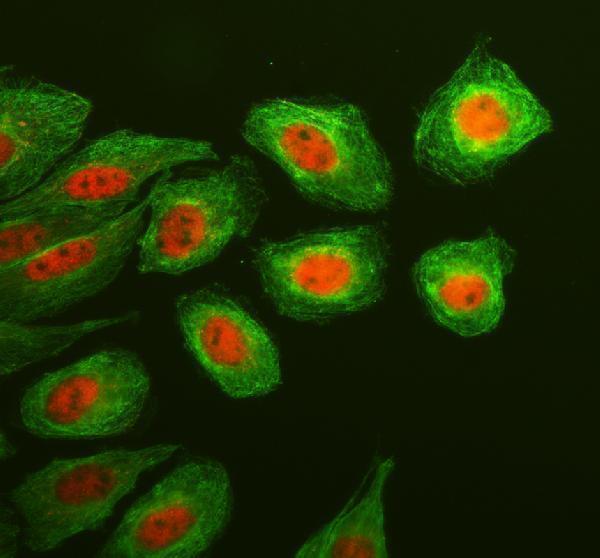 a00727 1 klf5 primary antibodies if testing 2