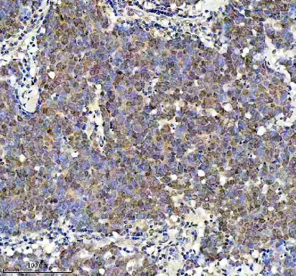 a00727 1 klf5 primary antibodies ihc testing 1