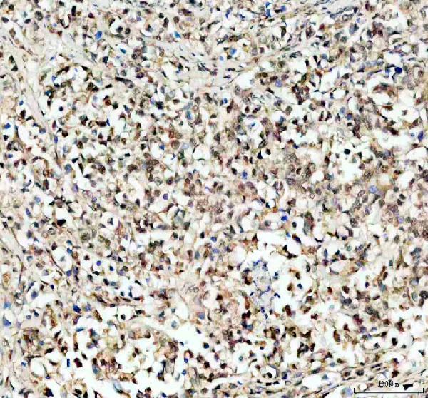 a00727 1 klf5 primary antibodies ihc testing 2_1