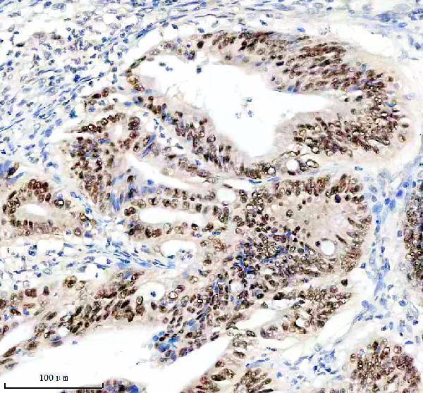 a00727 1 klf5 primary antibodies ihc testing 3_1