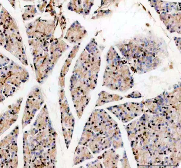 a00727 1 klf5 primary antibodies ihc testing 5_1