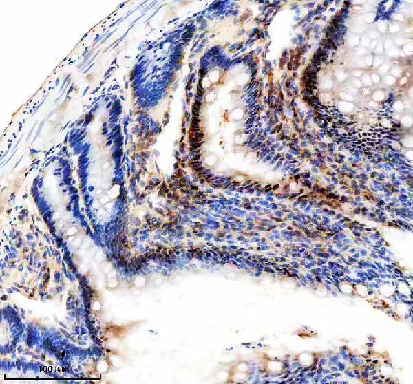 a00727 1 klf5 primary antibodies ihc testing 6