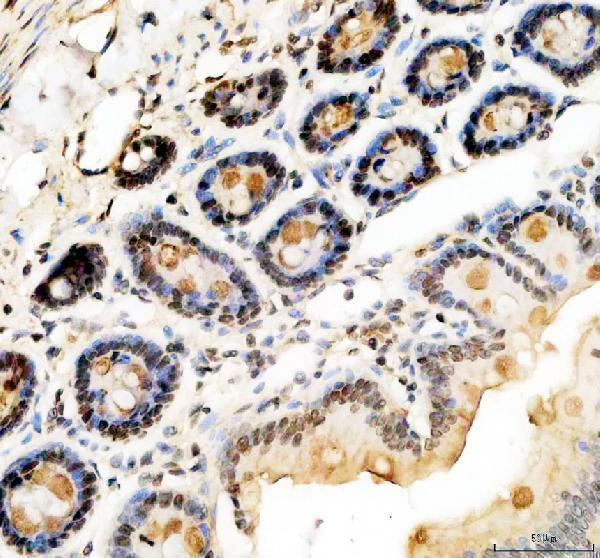 a00727 1 klf5 primary antibodies ihc testing 7