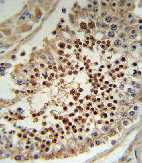 a00727 anti klf5 antibody c term ihc p testing 3