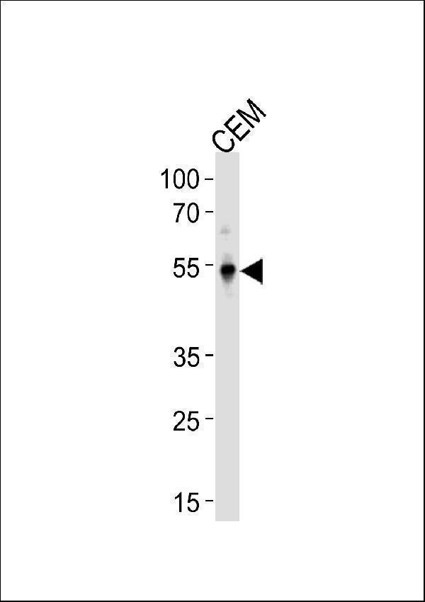 a00727 anti klf5 antibody c term wb testing 2