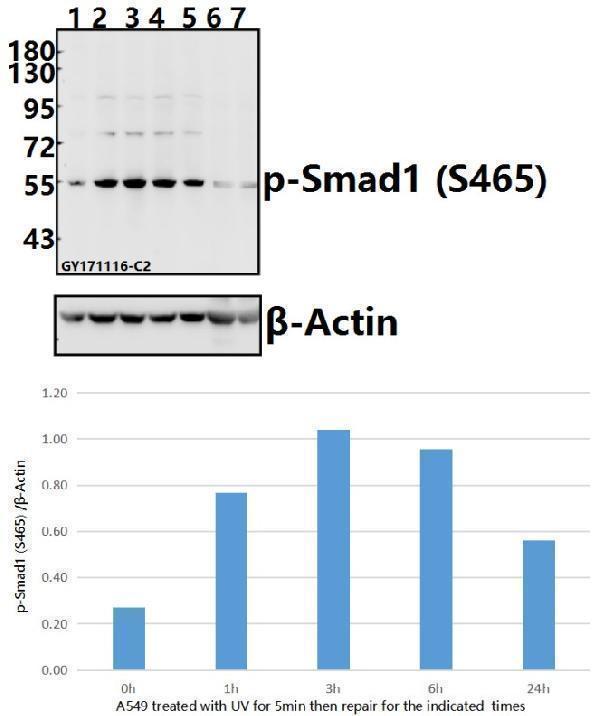Western blot (WB) analysis of p-Smad1 (S465) pAb at 1:500 dilution
Lane1:A549 whole cell lysate(40ug)
Lane2:A549 treated with UV for 5 minutes then repair for 1 hour whole cell lysate(40ug)
Lane3:A549 treated with UV for 5 minutes then repair for 3 hours whole cell lysate(40ug)
Lane4:A549 treated with UV for 5 minutes then repair for 6 hours whole cell lysate(40ug)
Lane5:A549 treated with UV for 5 minutes then repair for 24 hours whole cell lysate(40ug)
Lane6:The Uterus tissue lysate of Mouse(40ug)
Lane7:The Uterus tissue lysate of Rat(40ug)