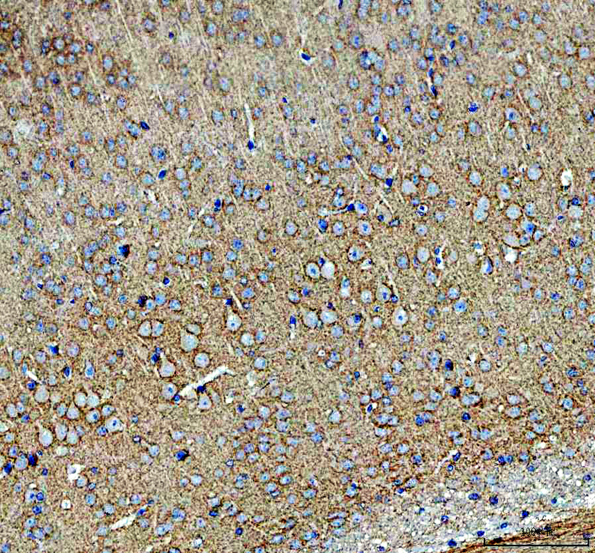 IHC analysis of L1CAM using anti-L1CAM antibody (A00729-4)