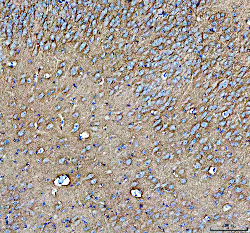 a00729 4 l1cam primary antibodies ihc testing 2