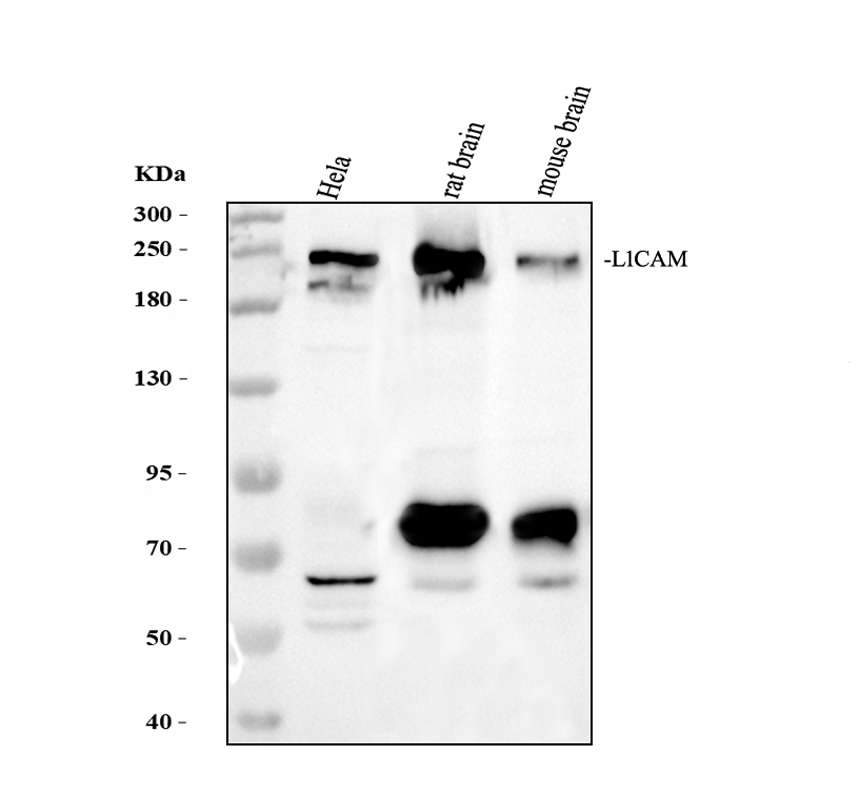 Western blot analysis of L1CAM using anti-L1CAM antibody (A00729-4)
