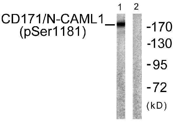 Western blot analysis of lysates from K562 cells, using CD171/N-CAML1 (Phospho-Ser1181) Antibody