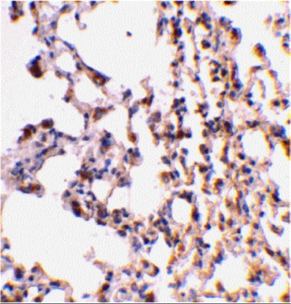 Immunohistochemical staining of mouse lung tissue using Bid antibody at 2 μg/mL