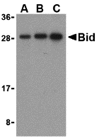 Western blot analysis of Bid in mouse lung cell lysates with Bid antibody at (A) 0