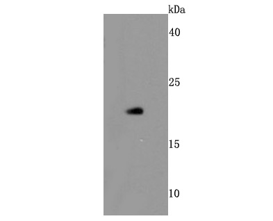 Western blot analysis of Bid on human thymus cells lysates using anti-Bid antibody at 1/500 dilution