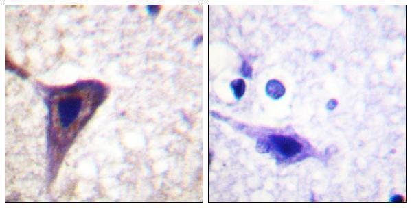 Immunohistochemistry analysis of paraffin-embedded human brain, using BID (Phospho-Ser78) Antibody