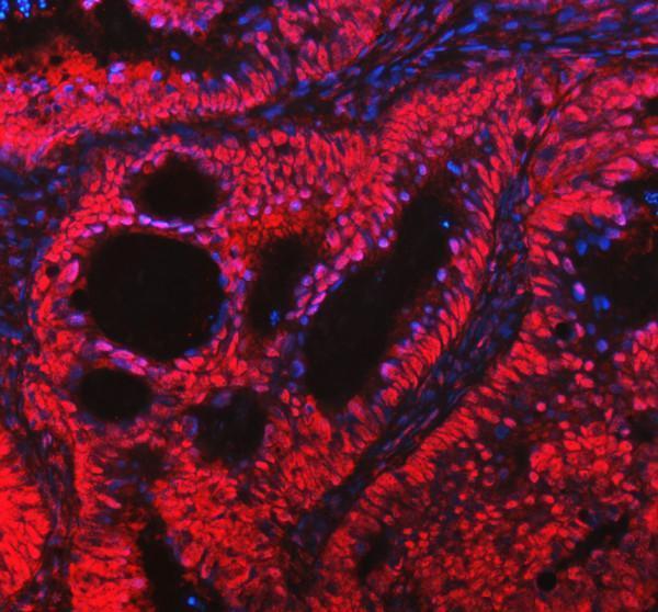 a00731 2 mre11 primary antibodies if testing 2