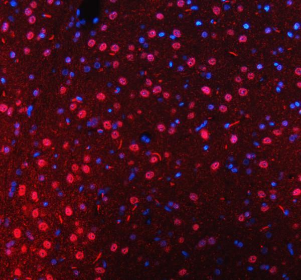a00731 2 mre11 primary antibodies if testing 3