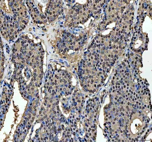 IHC analysis of MRE11 using anti-MRE11 antibody (A00731-2)