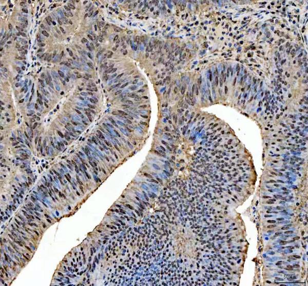 IHC analysis of MRE11 using anti-MRE11 antibody (A00731-2)