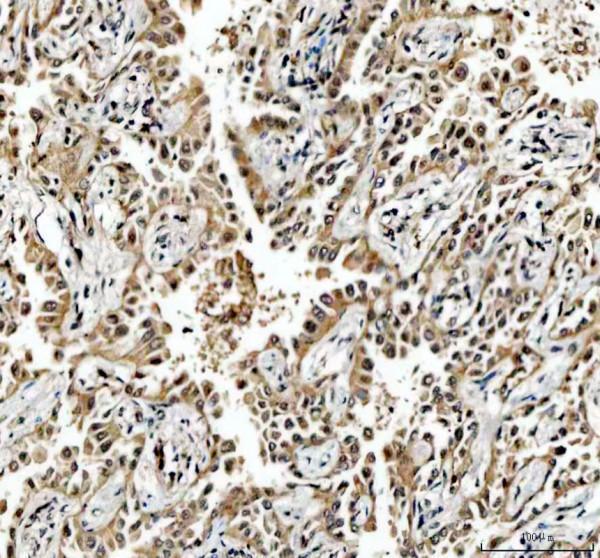 a00731 2 mre11 primary antibodies ihc testing 3