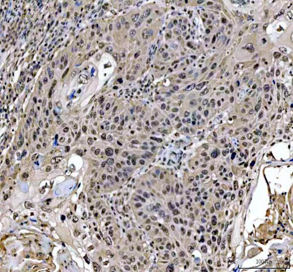 a00731 2 mre11 primary antibodies ihc testing 4