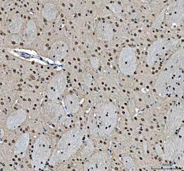 a00731 2 mre11 primary antibodies ihc testing 5