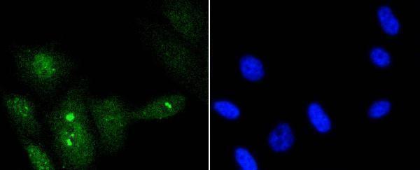 ICC staining Phospho-p95/NBS1(S343) in PC-3M cells (green)
