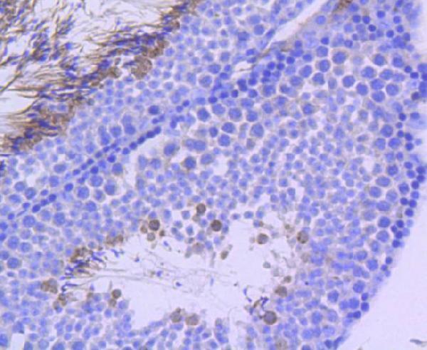Immunohistochemical analysis of paraffin-embedded mouse testis tissue using anti-Phospho-p95/NBS1(S343) antibody