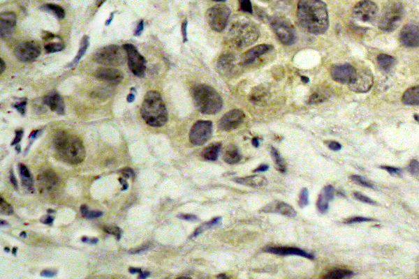 Immunohistochemistry (IHC) analyzes of p-p95/NBS1 (S343) pAb in paraffin-embedded human tonsil tissue