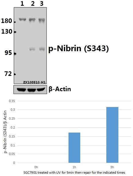 Western blot (WB) analysis of p-Nibrin (S343) pAb at 1:500 dilution
Lane1:HEK293T whole cell lysate(40ug)
Lane2:HEK293T treated with UV for 5 minutes then repair for 1 hours whole cell lysate(40ug)
Lane3:HEK293T treated with UV for 5 minutes then repair for 3 hours whole cell lysate(40ug)