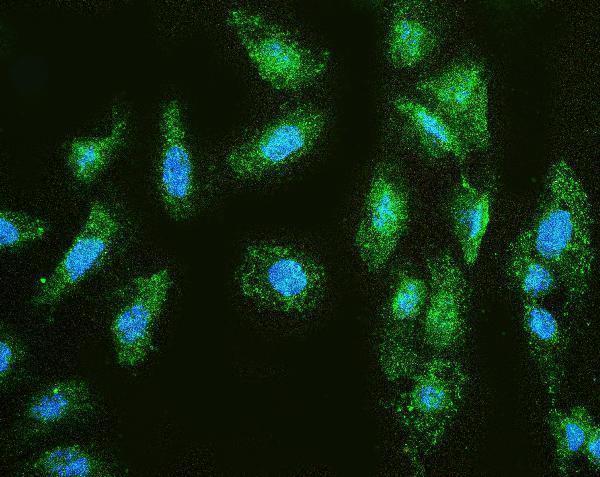a00733 1 mmp1 primary antibodies if testing 5